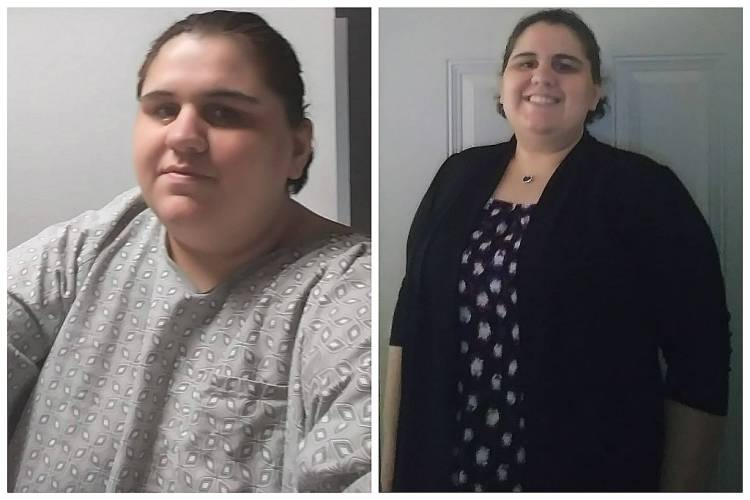Amanda Freitas Deal's With all of the What If's and Get's Her Life Changing Surgery