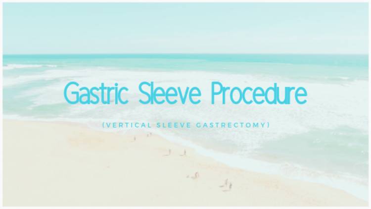 Gastric Sleeve Procedure