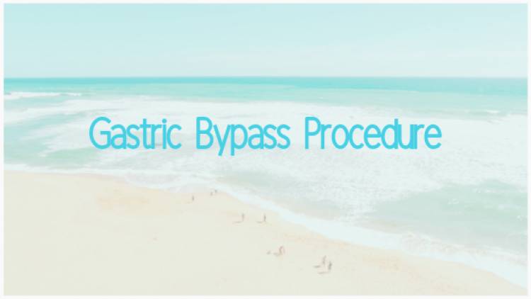 Gastric Bypass Procedure