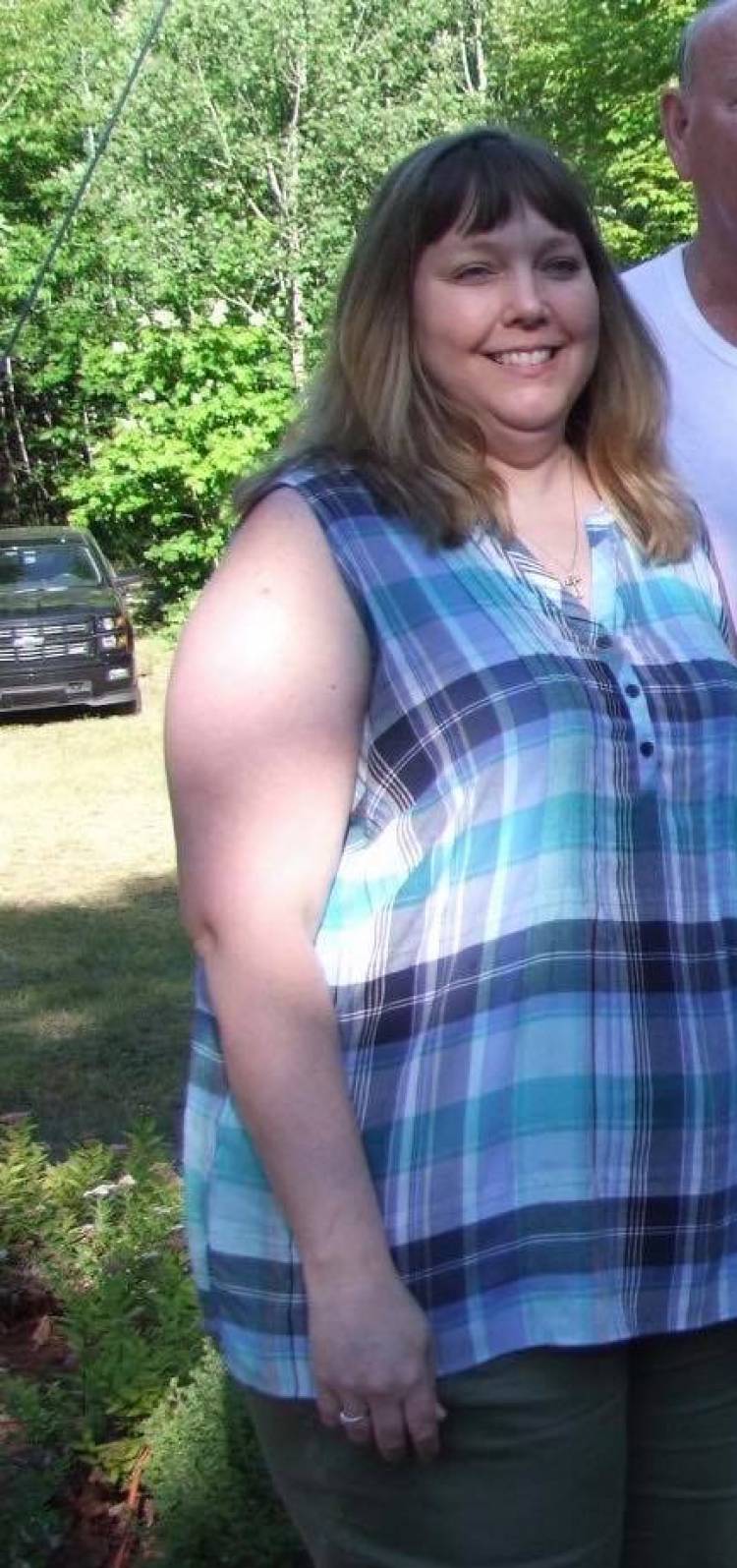 Ruth before surgery weighing 260