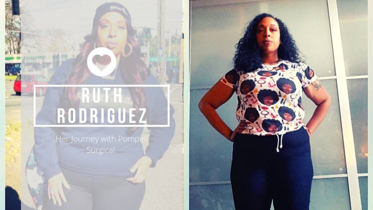 "I Can't Thank Pompeii Surgical Enough for Giving Me a New Outlook on Life." -Ruth Rodriguez